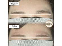 サロンロン 横浜関内(SALON RON)の雰囲気（ムダ毛が無くなるだけでスッキリ！左右差も目立たなく♪）