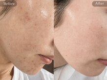 エスラ 中目黒店(S:RA)の雰囲気（【満足度96.4％】あなた専用のオーダーメイド肌管理をご提案！）