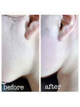 ルルゴ(LULUGO)/ブラジリアンワックスお顔