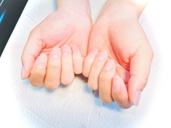 チャクラジュニア(CHAKRA.jr)の写真/爪の形がコンプレックス…そんなお悩みをお持ちの方にオススメ！本格ケアで健康的な美爪へ導きます♪