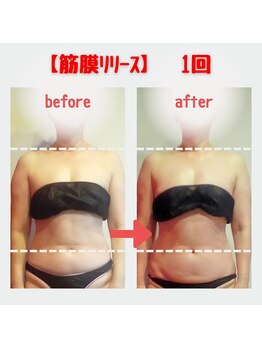 ビューティサロン キヨの部屋(beauty salon)/【筋膜リリース】　１回