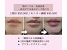 韓国最新美容！唇のくすみ・メラニン除去  50,000円→45,000円