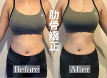 トップフェイス(Top Face)