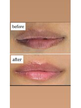 アヌヘア(Anuhea)/ローマピンク