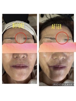 パールブルー(All Perl blue)/キュラハ韓国エステ