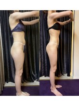 アスエ(ASUE)/エンダモロジー＋サーモシェイプ