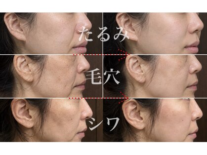 多穏スキンケア(skin care)の写真