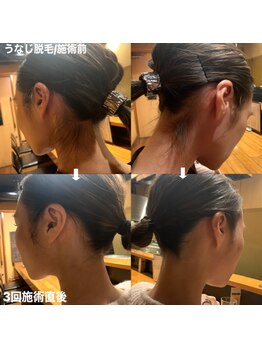 アンリミット(Unlimit)/うなじも意外と見られてます!