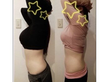 ザミッション(The Mission)/痩身マシン ボディスカルプト