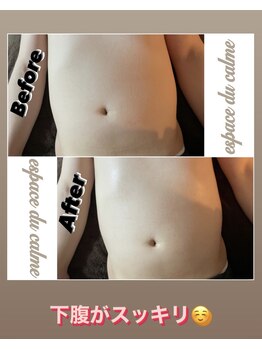 カルマーアンドビー(Calmer & Be.)/【メンズ痩身】Before/After