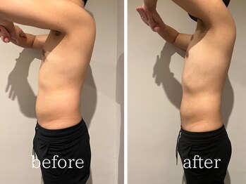 サンク(Cinq)/【腸もみ+痩身機器】ダイエット