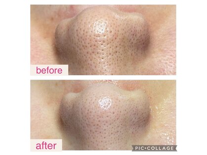 ミハナ(mihana)の写真