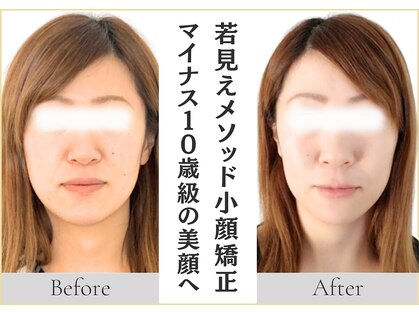 アロハ(ALOHA.)の写真