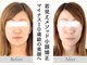 アロハ(ALOHA.)の写真