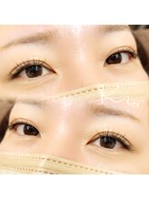 クレー(Klee)/フラットラッシュ100本