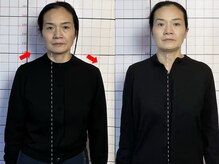 プーラビタ(PURAVITA)/姿勢不良からくる肩こり頭痛