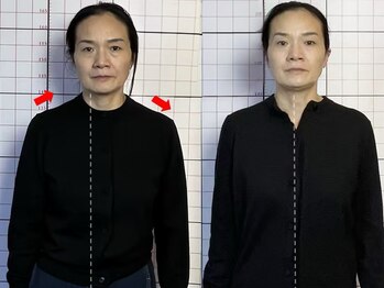 プーラビタ(PURAVITA)/姿勢不良からくる肩こり頭痛