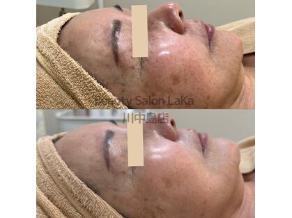 ラカ 川中島店(LaKa)の写真