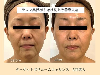 パンセリーノ(Panselinos)の写真