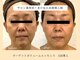 パンセリーノ(Panselinos)の写真