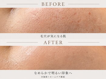 ハス(hasu.)/