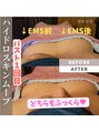 トリートメント アンド コミュ トリコ 新しくなった“高性能MYBバスト”はEMSも追加でさらに効果UP♪