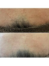 シャンティ(Shanti)/富士額でお悩みのお客様