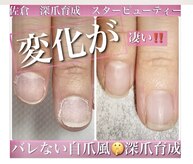 スターネイル(Starnail)