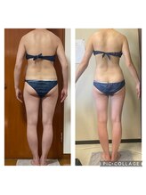 美ボディラボ(美Body Labo)/痩身専門だからこその技術