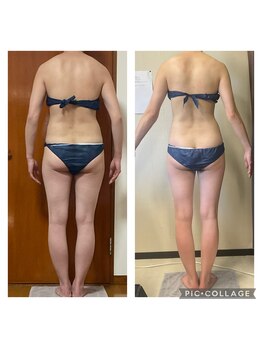 美ボディラボ(美Body Labo)/痩身専門だからこその技術