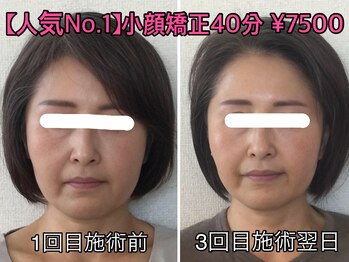小顔矯正サロン ぷてぃらっく