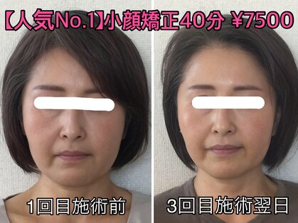 小顔矯正サロン ぷてぃらっくの写真
