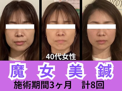 パンダ(Panda)の写真