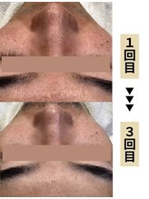 ディレイア ザ コスメ 有楽町マルイ店(direia the cosme)&nbsp;40代 (男性)