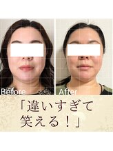 スウ(suu.)/Before-After【40代】12 回