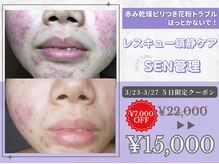 スキンラボアメリ(skin lab. ameri)