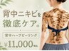 【夏の準備に】ニキビ・ざらつき改善|韓国式ハーブピーリング(背中)