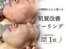 アルフォービューティー 難波店(ALU for beauty)