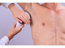 最新鋭の脱毛マシンでの施術でしっかり結果がでます◎