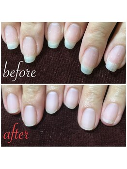 クリアジェル マットコート Pg ネイル チップス 天文館本店 Nail Tips のフォトギャラリー ホットペッパービューティー