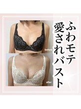 デミーナ(Demyna)/【バストアップ】症例 育乳