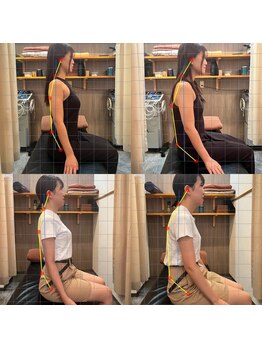 ウララカエイト(URARAKA8)/猫背スペシャル