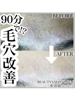 エムアンドエム(M&M)/