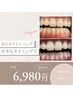【2回目以降の方限定！】セルフホワイトニング20分×2回　¥6,980