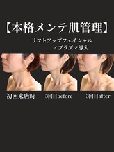 ノーブルノアール(Noble noir)/若見えリフトアップ☆