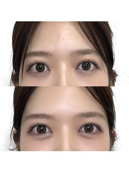 メゾンカラクル/涙袋メイクビフォーアフター