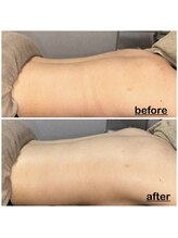 ミニョン(mignon)/今から夏の美肌準備！