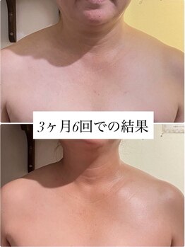 リラル(RERAR)/全身リンパ60分+ヘッドスパ20分