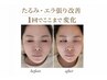 4月残り5名|二重あご・むくみ卒業 【引き締め小顔】フェイスラインケア