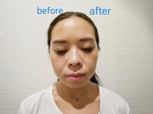 ギフト(GIFT)の雰囲気（片側のみヘッドスパをしたところ、左右で驚きの変化！小顔効果◎）